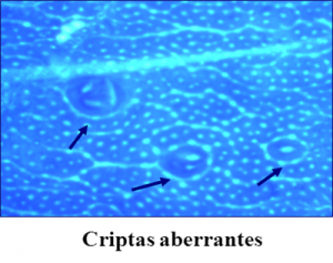 Criptas aberrantes